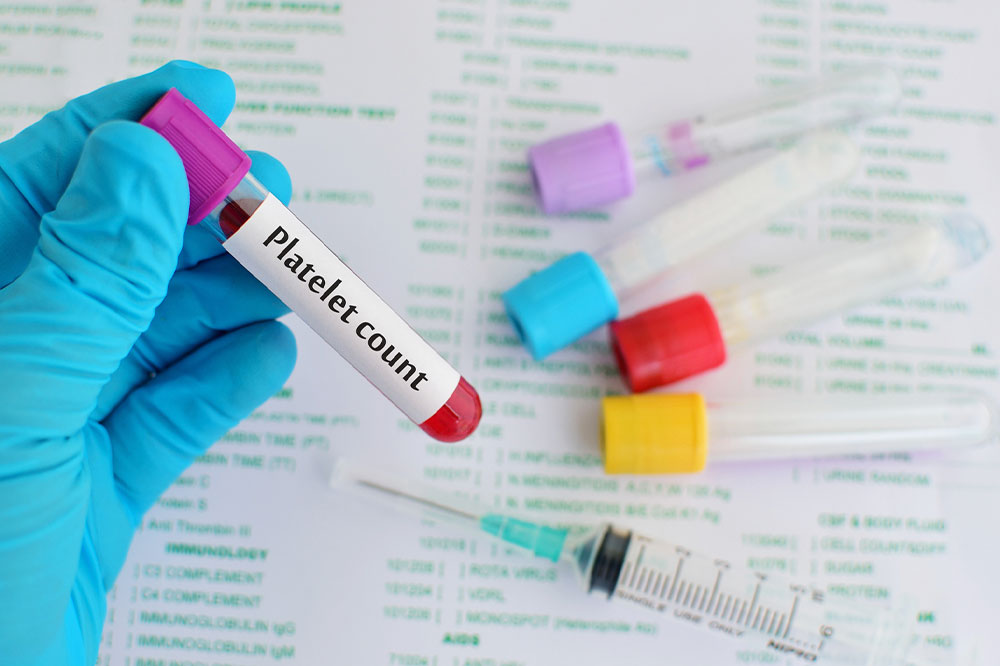 Low Platelet Count – Ways to Manage the Condition