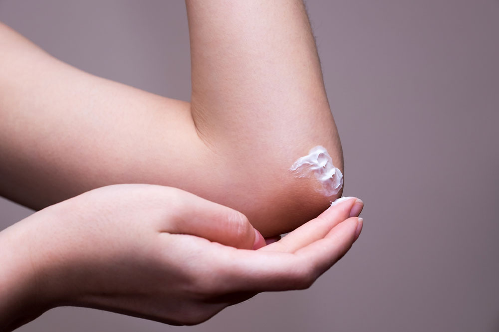 Ringworm – Transmission, Risk factors, and More