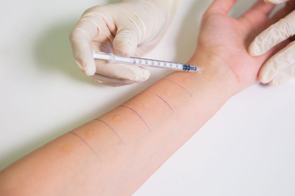 Here’s how you can get your allergies detected