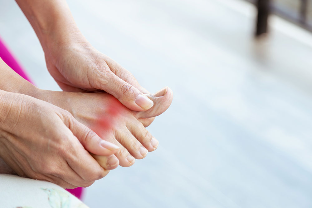 Gout – Diagnosis, stages, and prevention